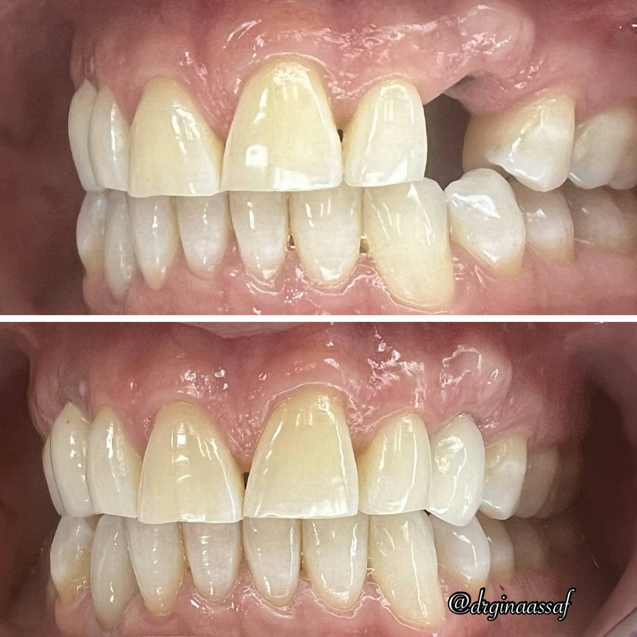 created by photogrid